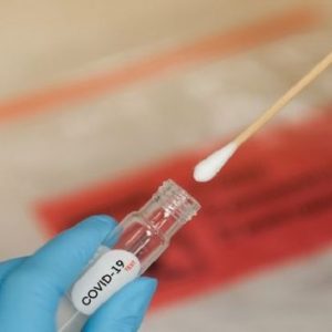 Ekonom INDEF Sebut Penurunan Harga Tes PCR Bisa Tingkatkan Tracing Covid-19
