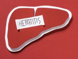 Kenali 10 Tanda Hepatitis yang Tidak Boleh Diabaikan