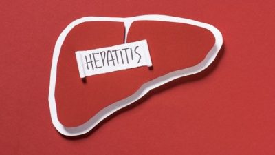 Kenali 10 Tanda Hepatitis yang Tidak Boleh Diabaikan