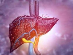 Kemenkes Ungkap Riwayat Kesehatan 3 Anak di Jakarta yang Meninggal Akibat Hepatitis Akut Berat
