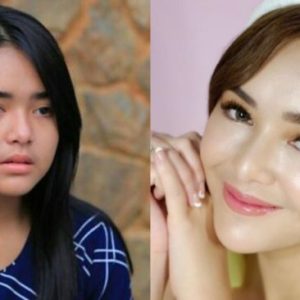 10 Potret Amanda Manopo Sebelum dan Sesudah Perawatan