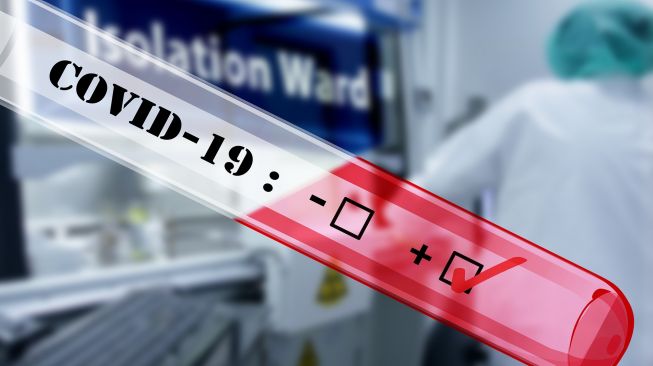 Tambah 14.518 Kasus Baru, Jumlah Positif Covid-19 RI 1.066.313 Orang